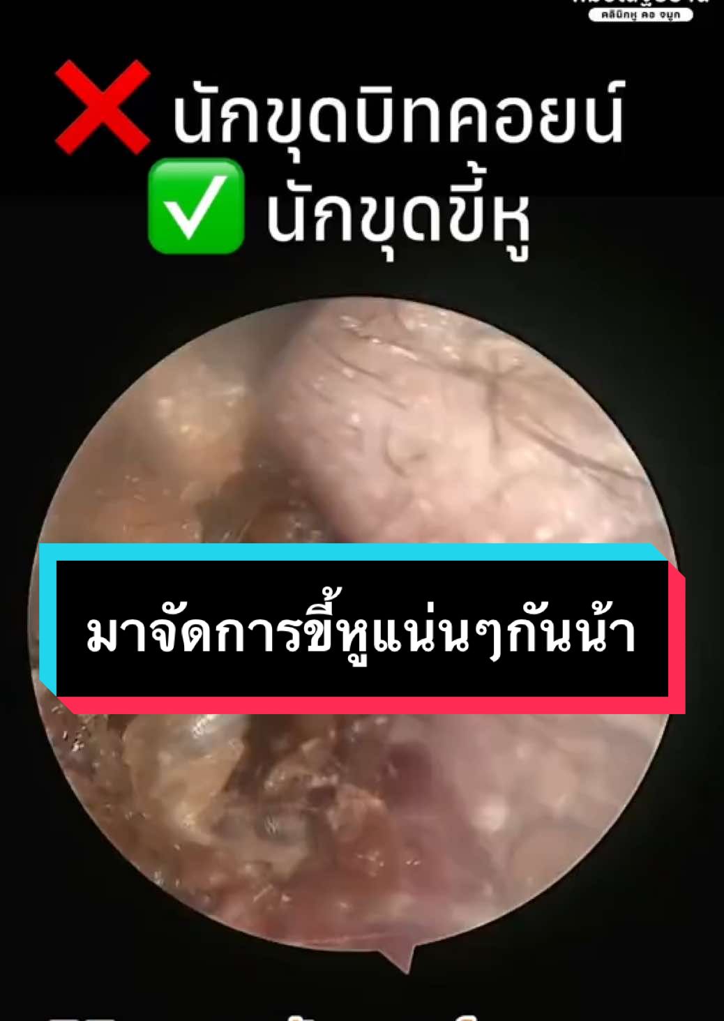 @คลินิกหมอณัฐธยาน์ หู คอ จมูก