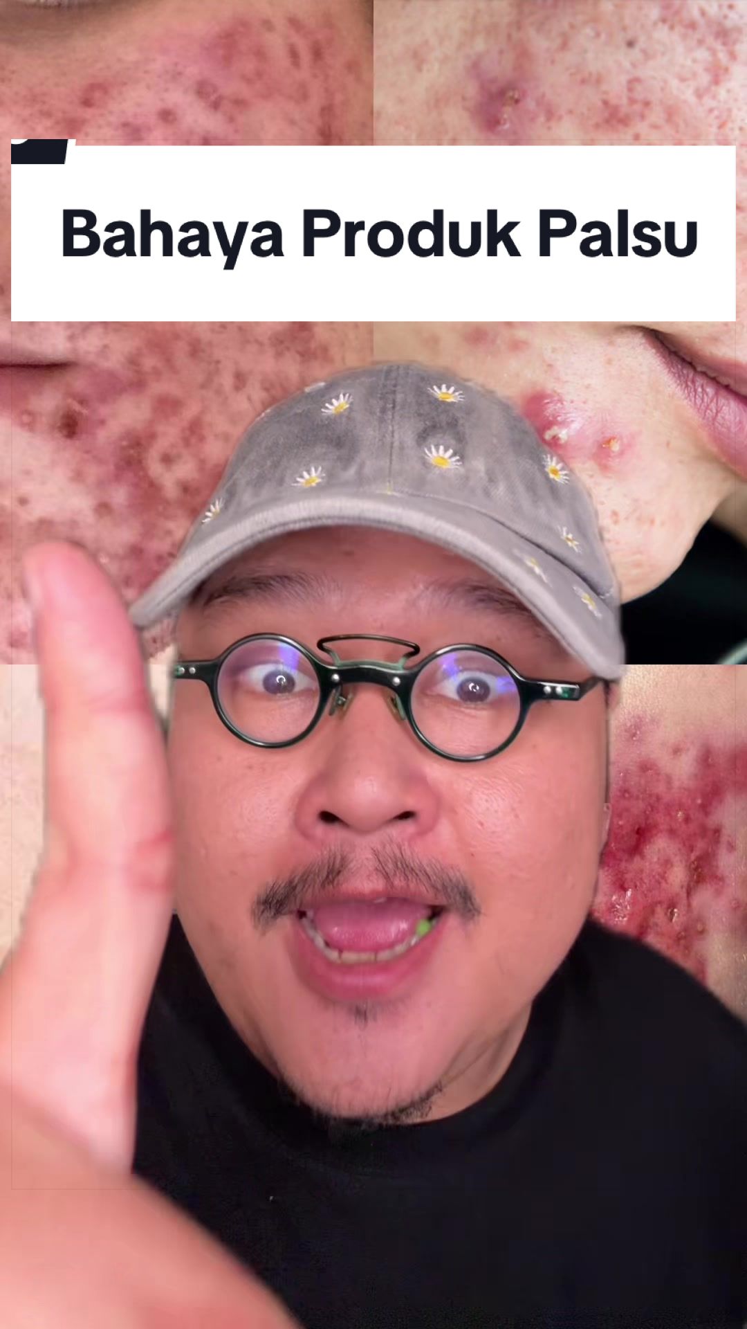 @Ali | @HungryForSkincare