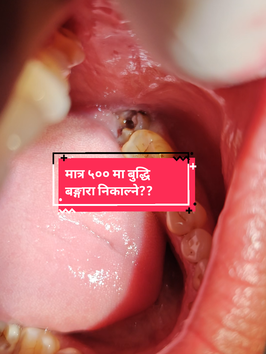 @Deardentist(म-डेन्टिस्ट)