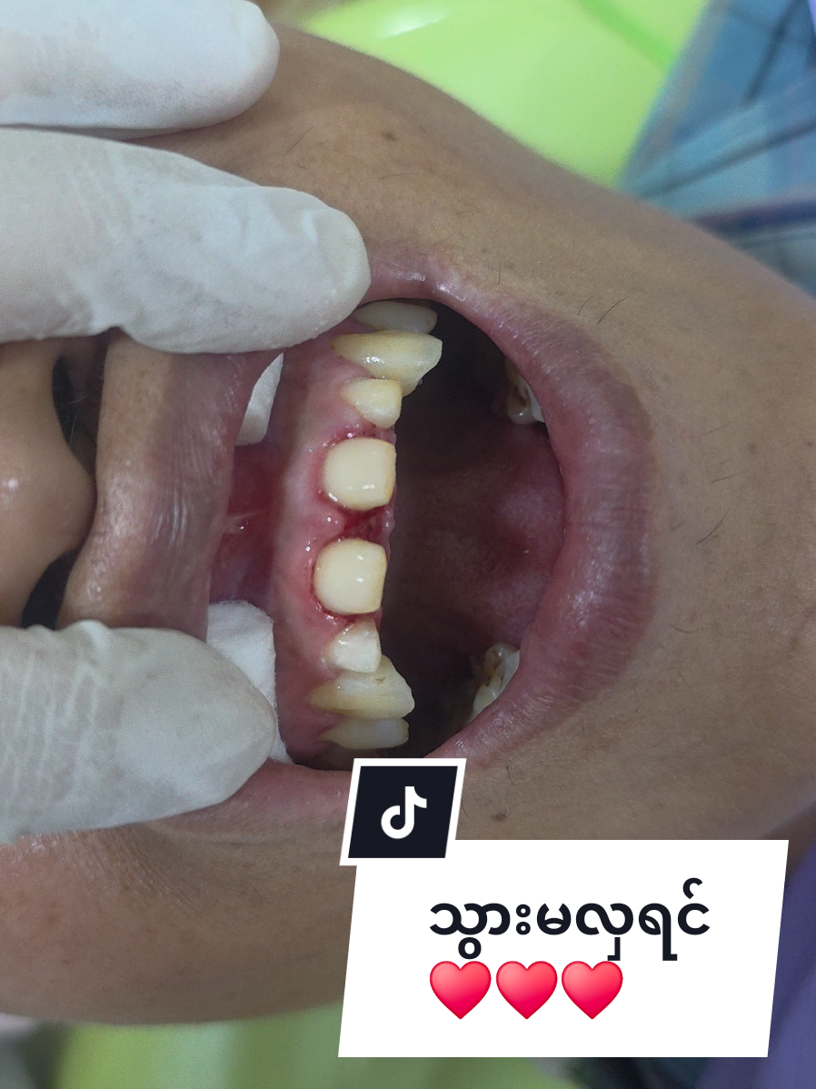 @Dr.KoKoSawMin(သွားဆရာဝန်)