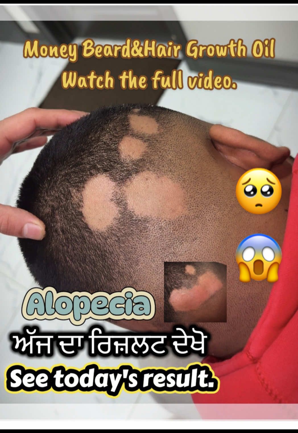 @money_beard_growthoil