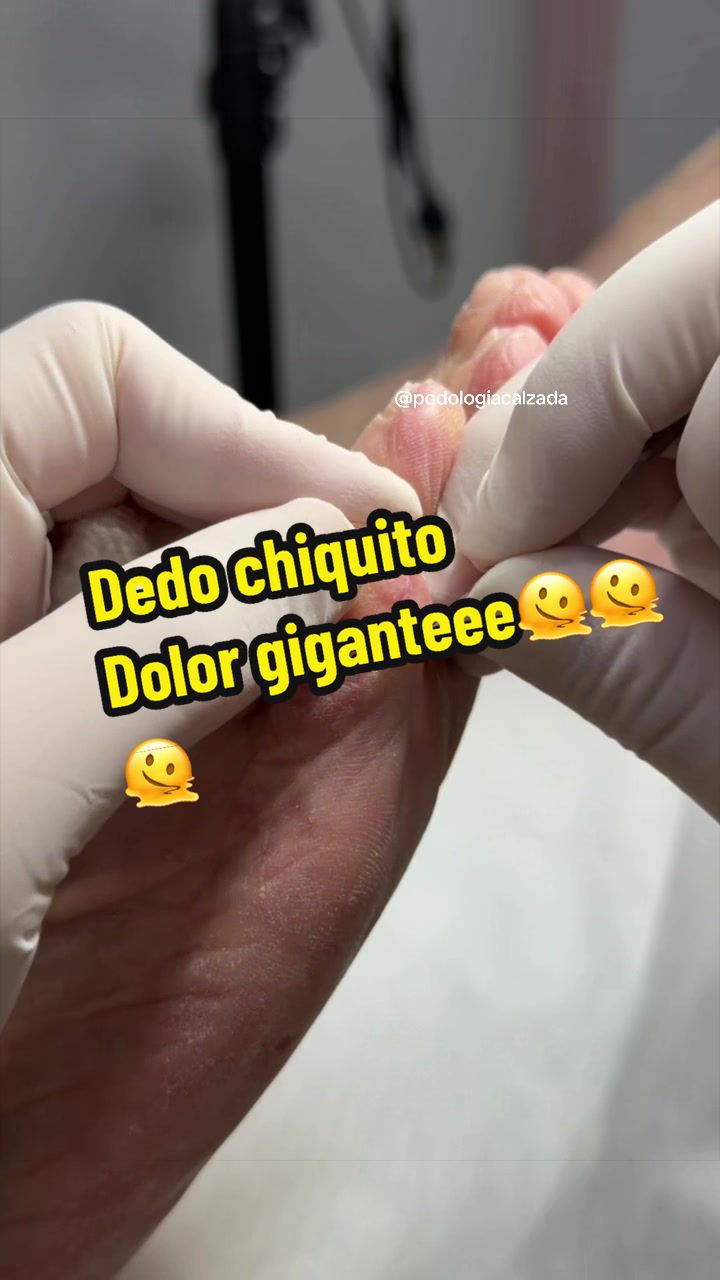 @podología calzada