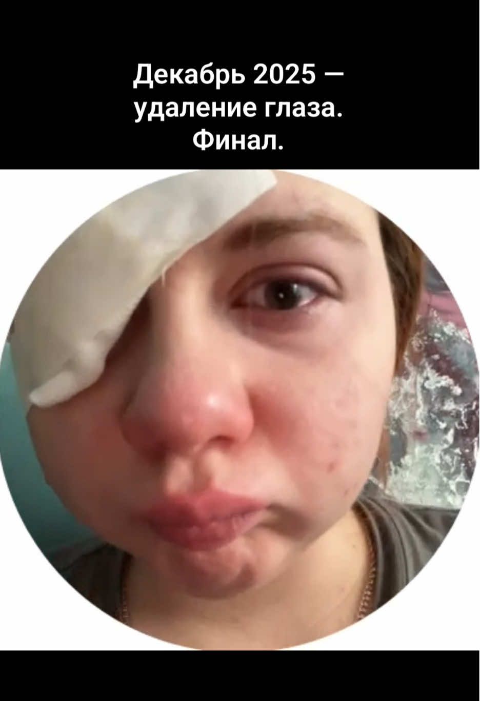 @тгк: рыжая алёля