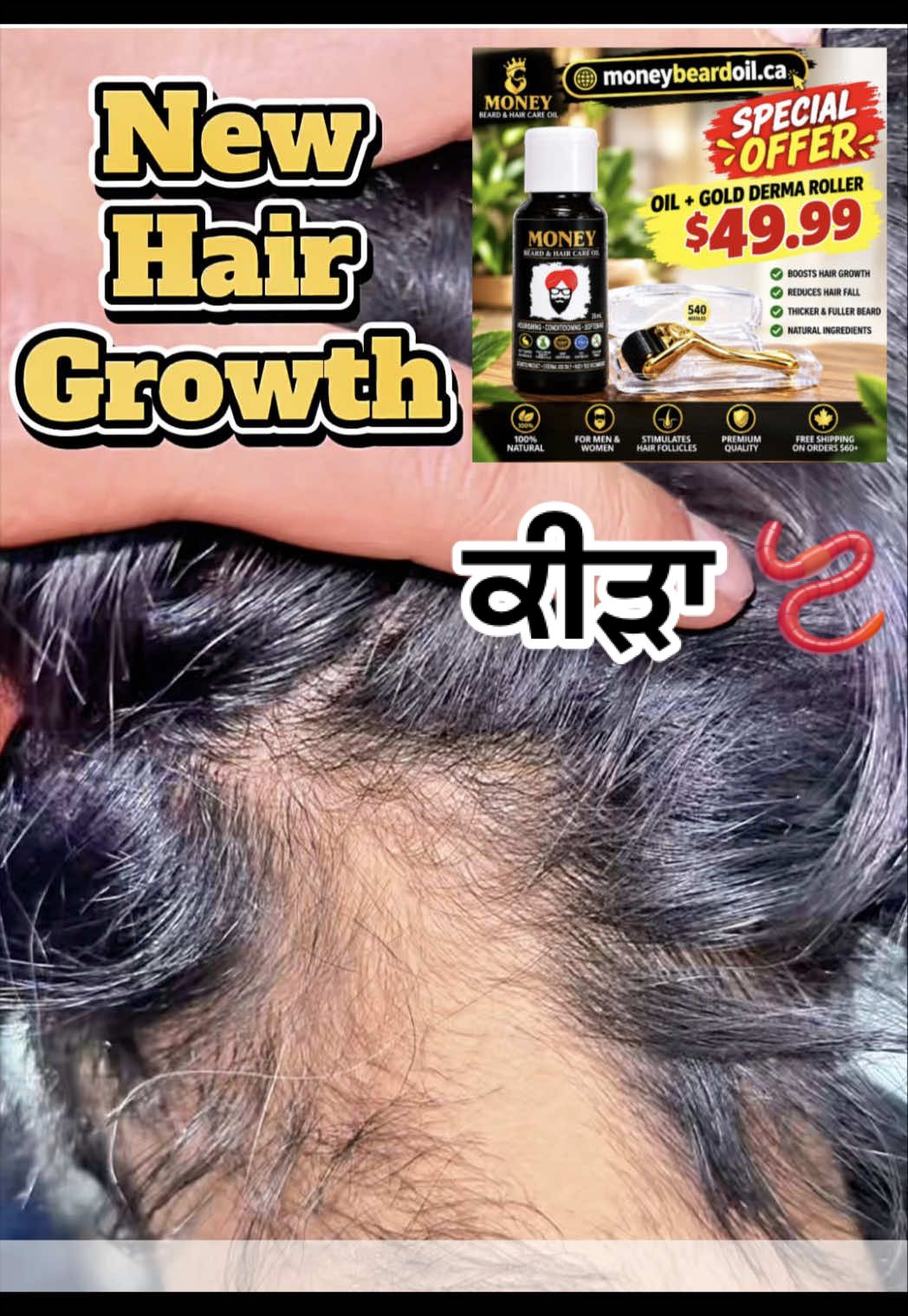 @money_beard_growthoil