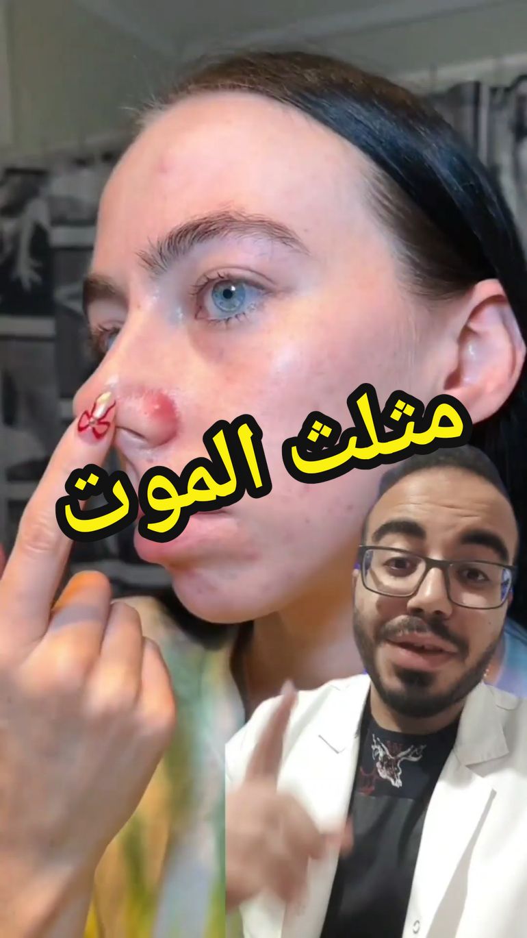 @Dr.ahmedsherif