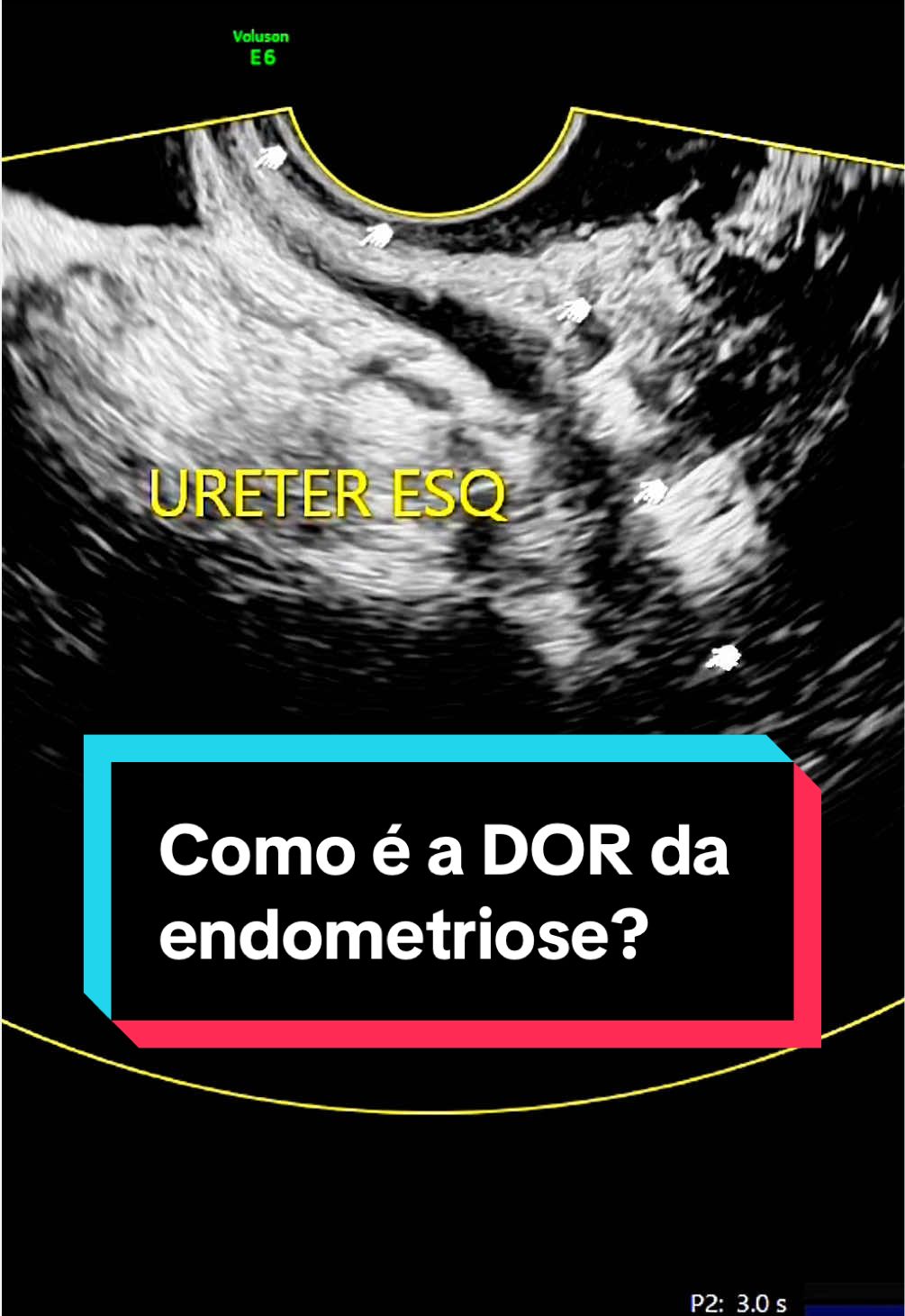 @Mega Imagem