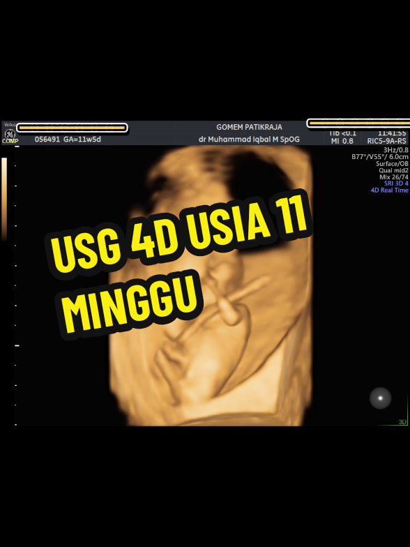 @USG 4D PURWOKERTO