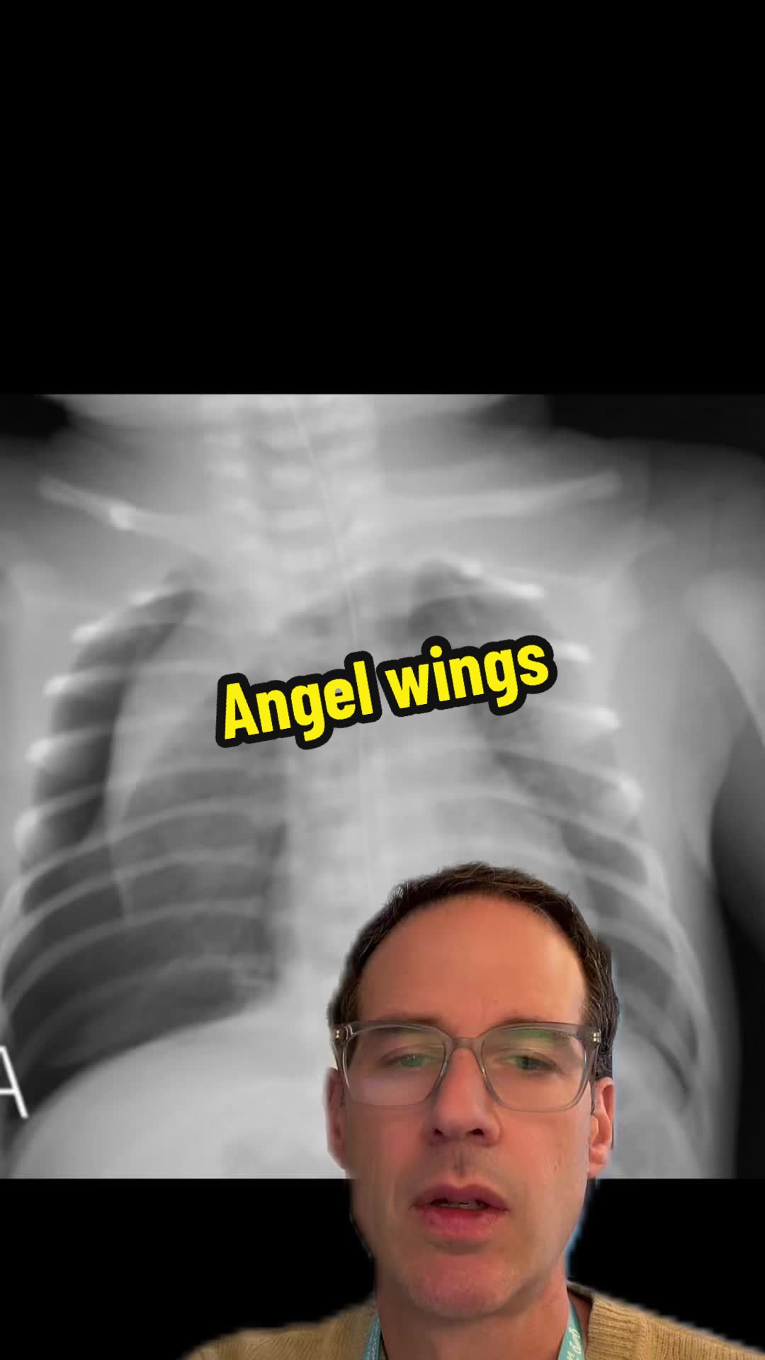 @Dr Michael Narvey 🇨🇦