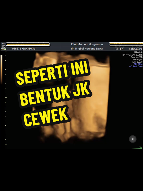 @USG 4D PATIKRAJA