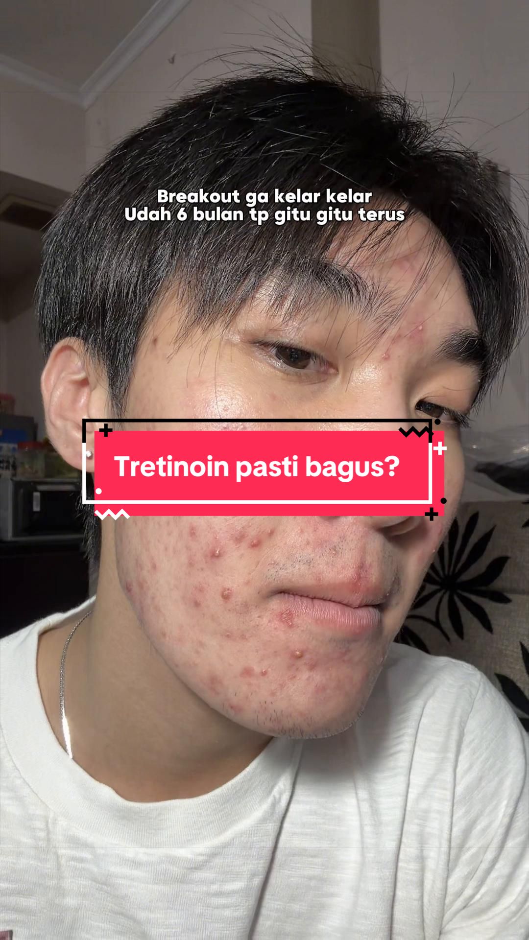 @Mau kulit sehat