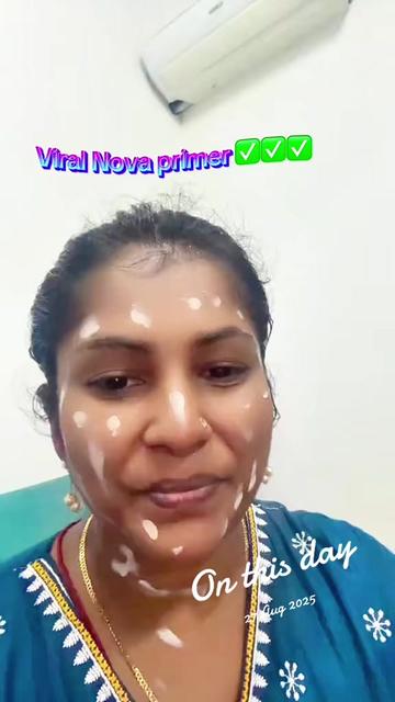 @Kanivu Sunshine