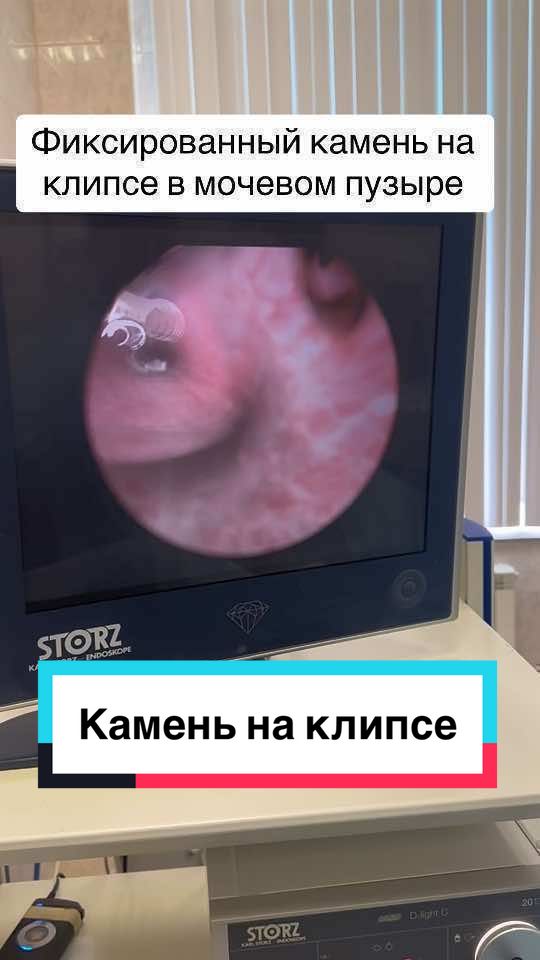 @Denis Davydov