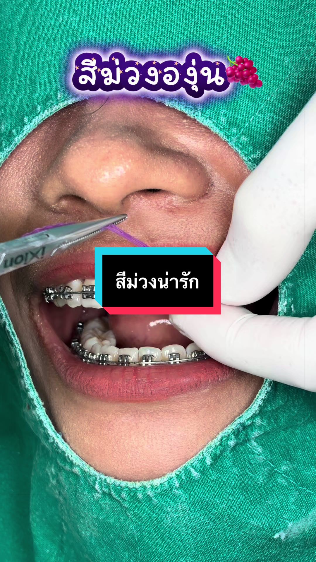 @ซอฟแอนด์สไมล์ลาดกระบัง