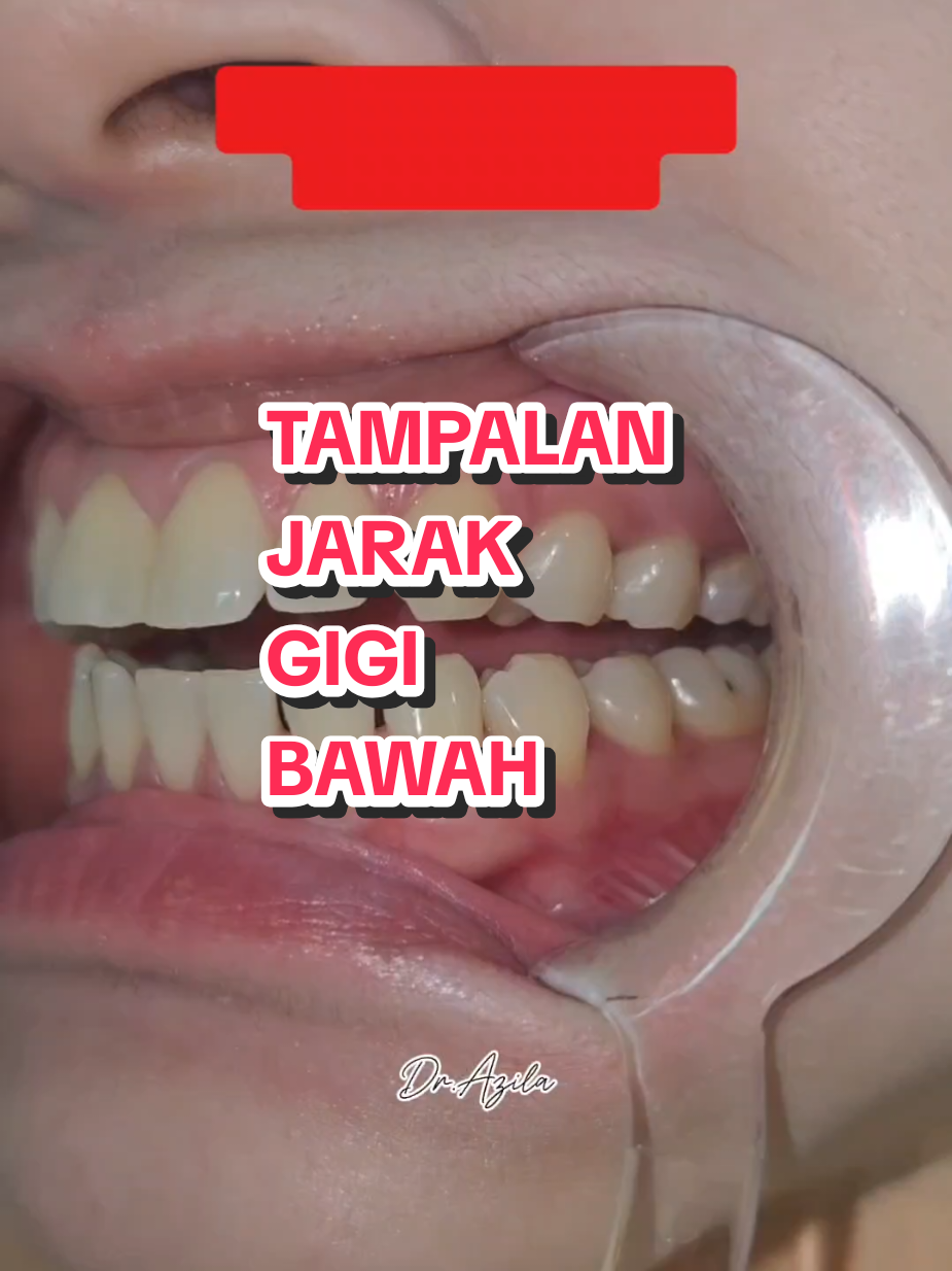 @Dr. Azila