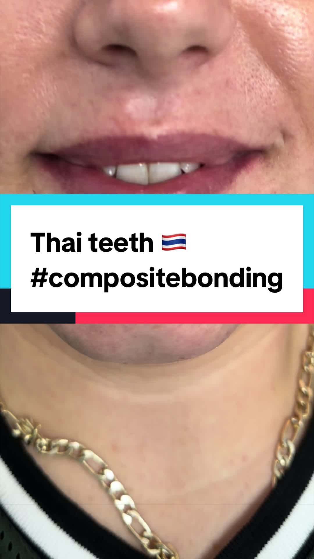 @Dr.MingSmile &hearts;️ Bangkok&Krabi