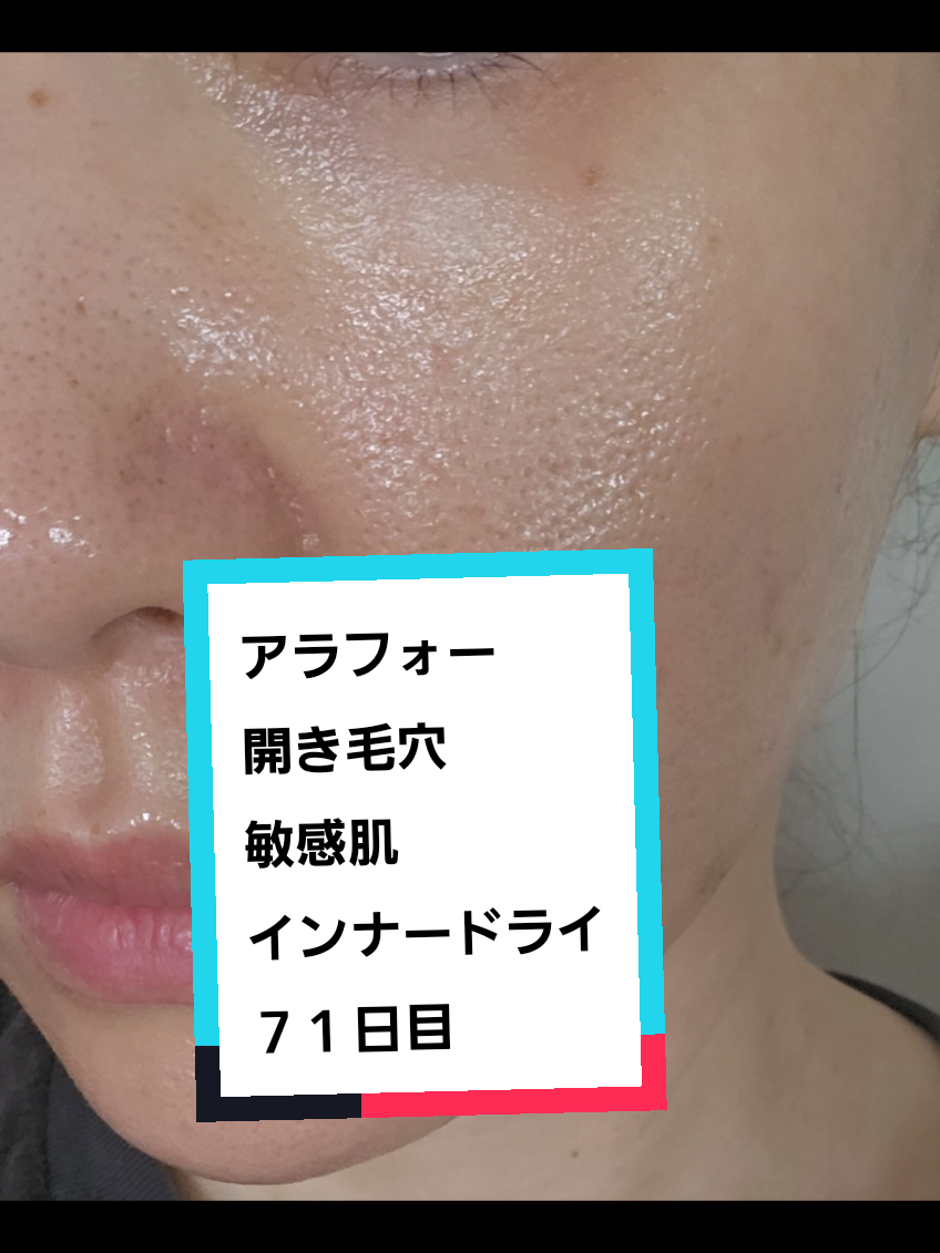 @リアル毛穴改善記録