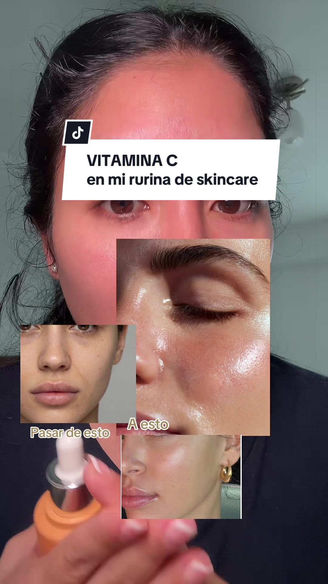 @Skinbonitta