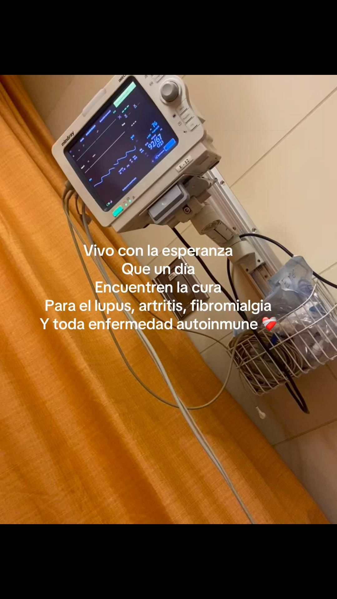 @Dayiss