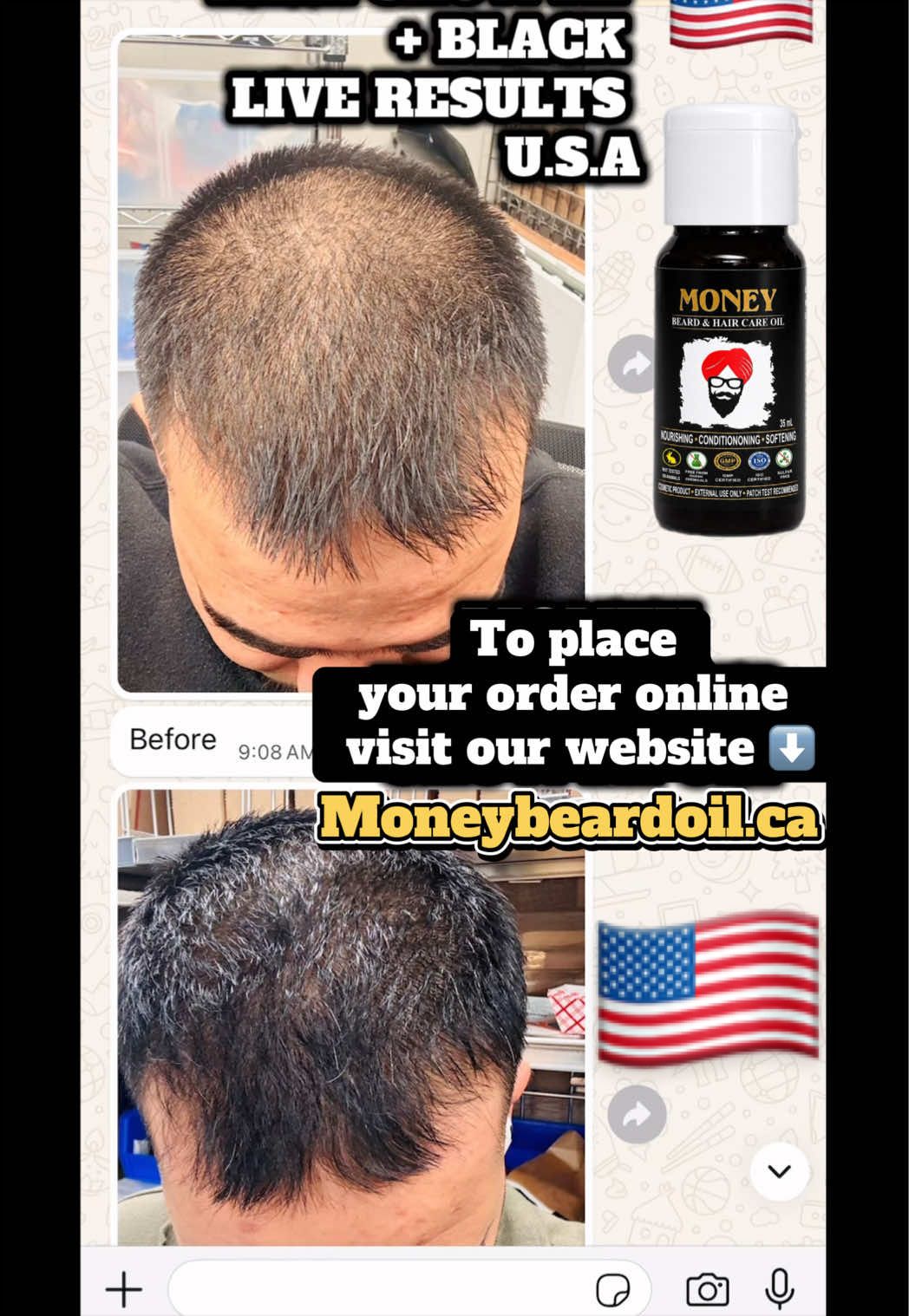 @money_beard_growthoil