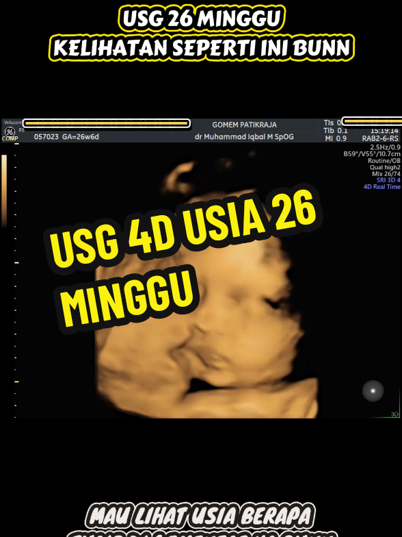 @USG 4D PURWOKERTO
