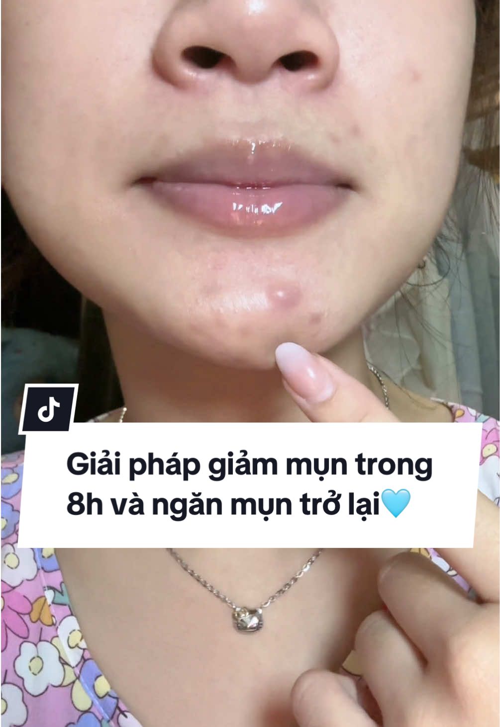 @Yenni Daily