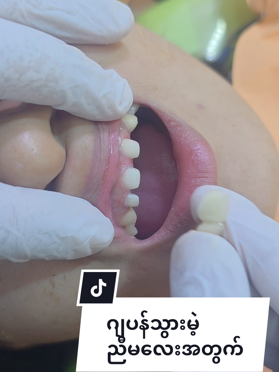 @Dr.KoKoSawMin(သွားဆရာဝန်)