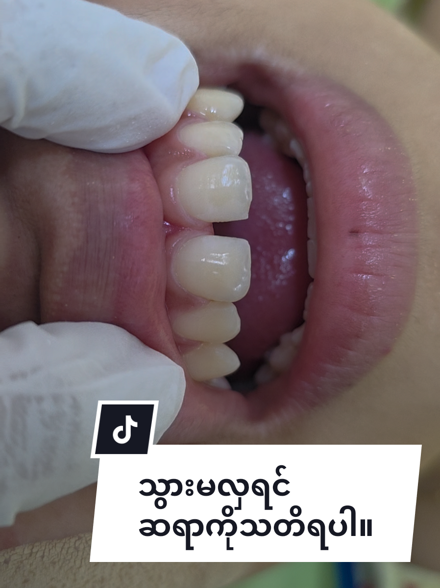 @Dr.KoKoSawMin(သွားဆရာဝန်)