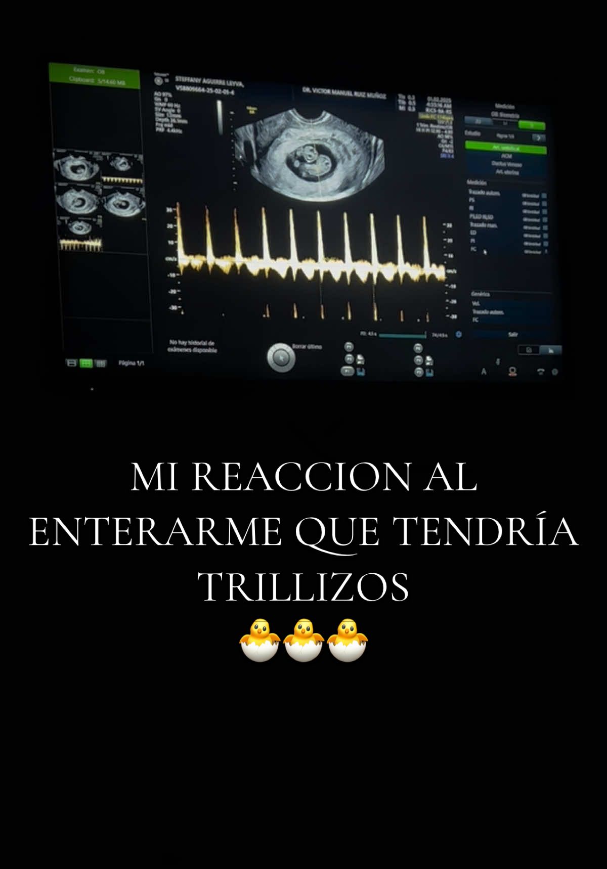 @tripleamorr