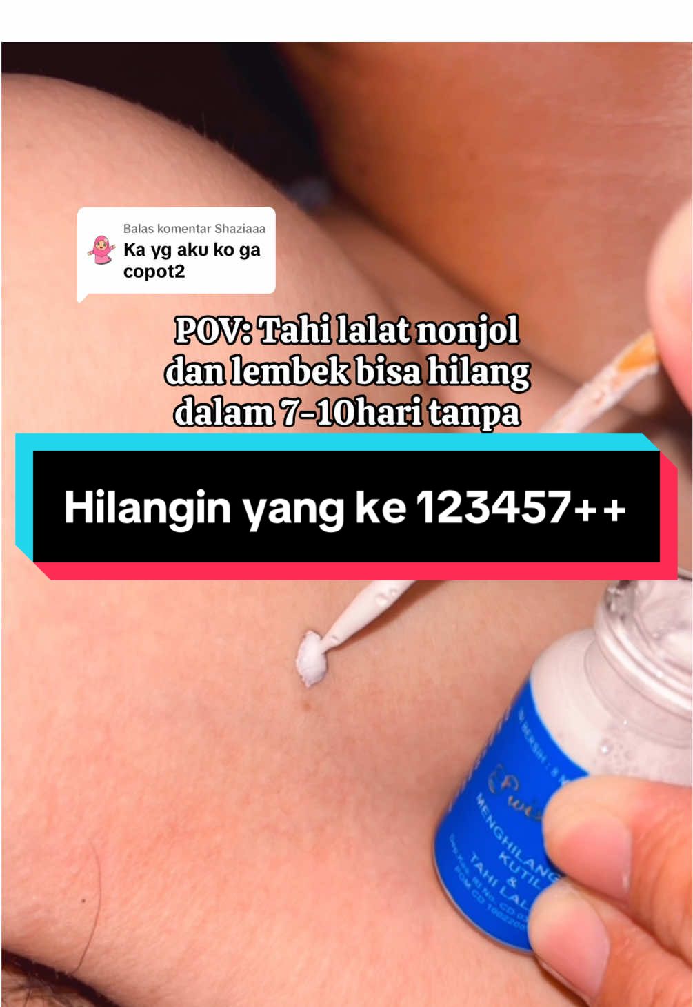 @Penghilangtahilalat.kaq.ay