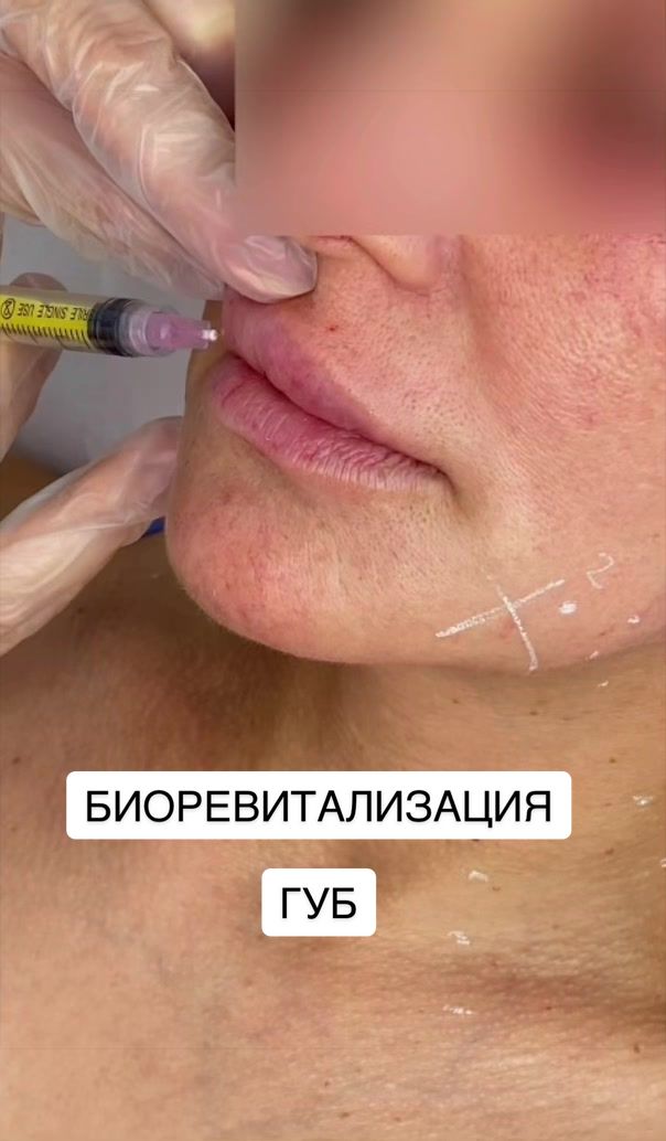 @dr.anush.cosmetolog