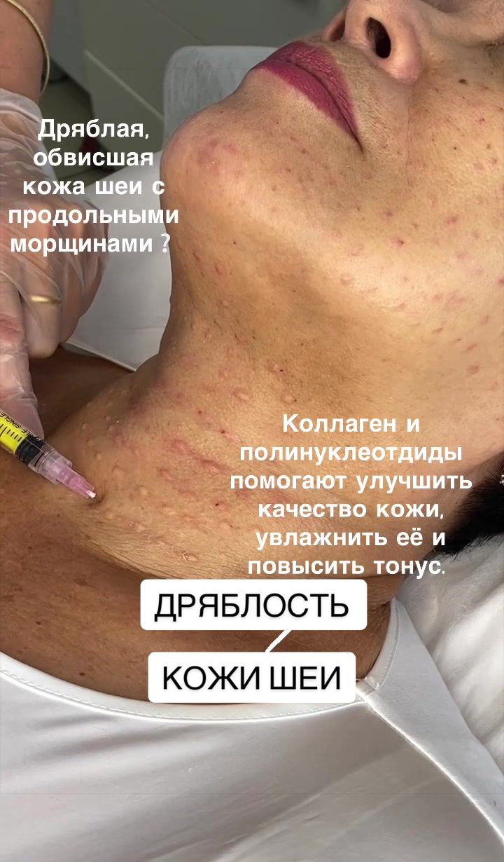 @dr.anush.cosmetolog