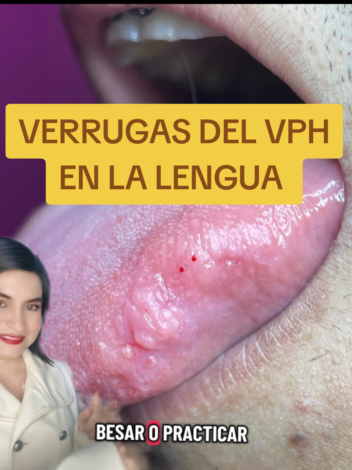 @VPH2025