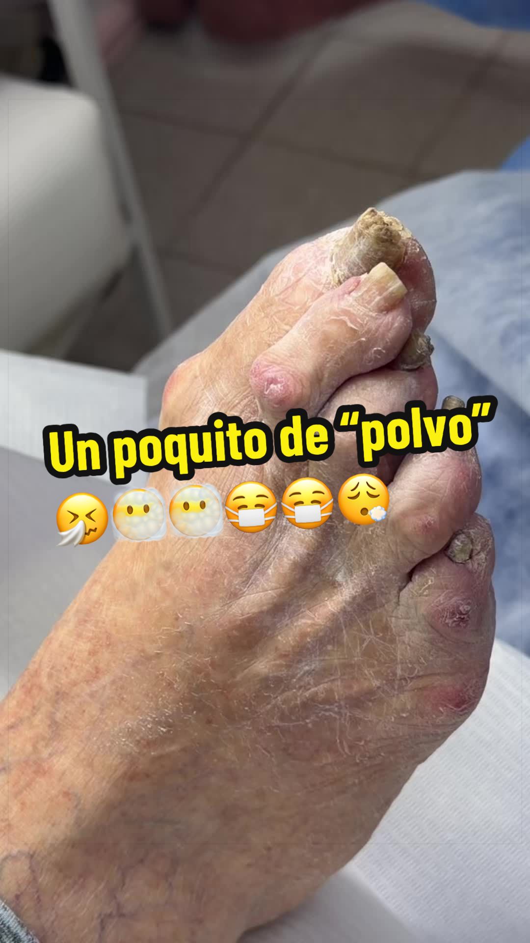 @podología calzada