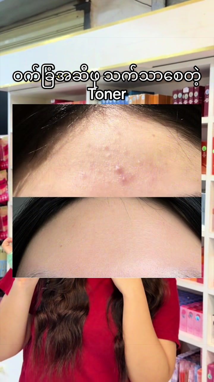 @FB: TheingiKyawSkincareShop