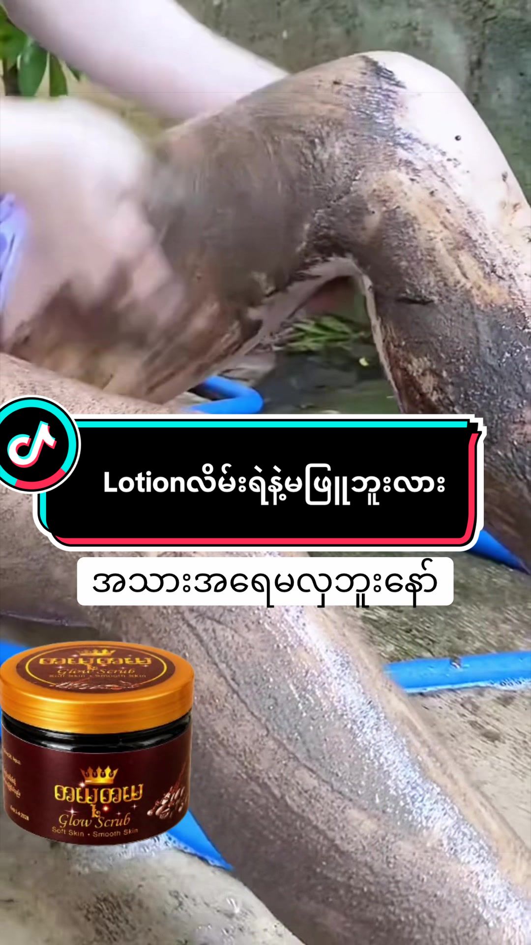 @Zin Mar (တယုတယ)