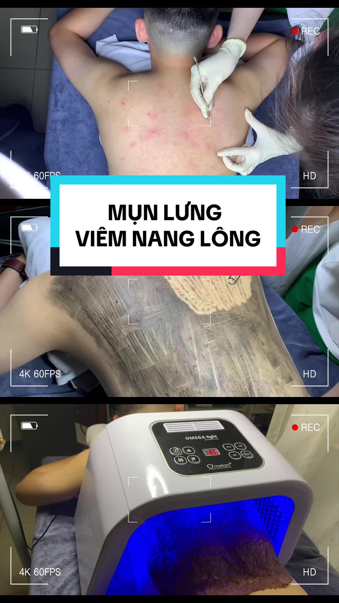 @Ring_Spa