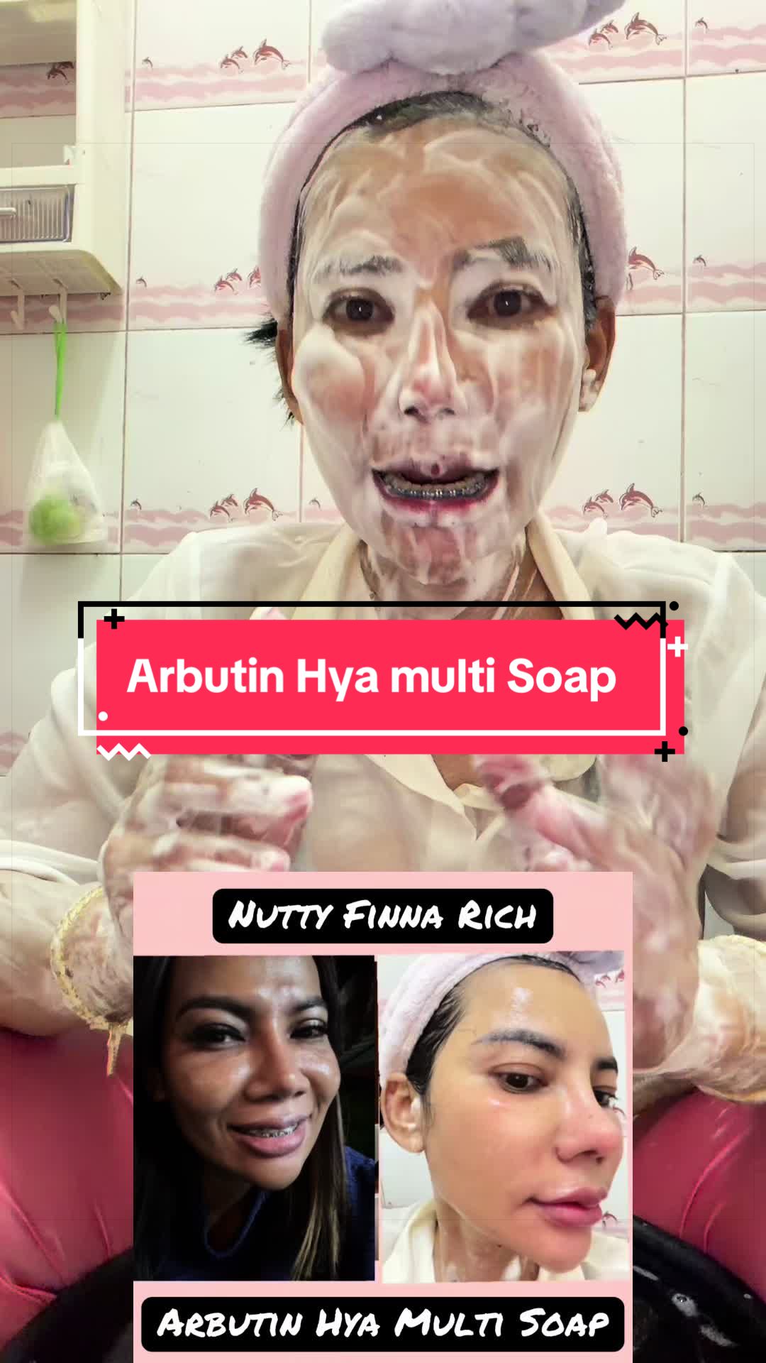 @นัตตี้คือความโชคดี