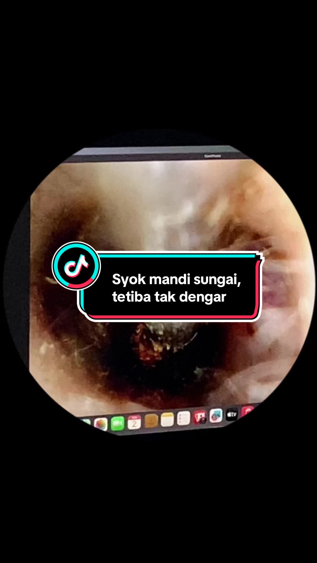 @Klinik Aqwa Care