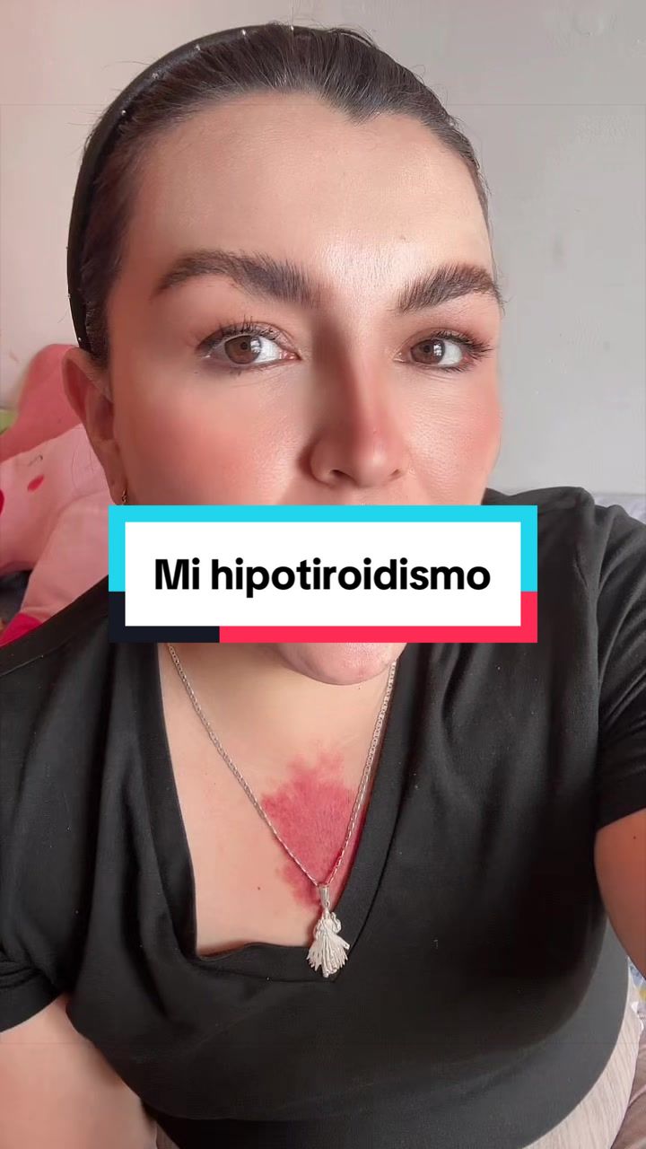 @jossrohe