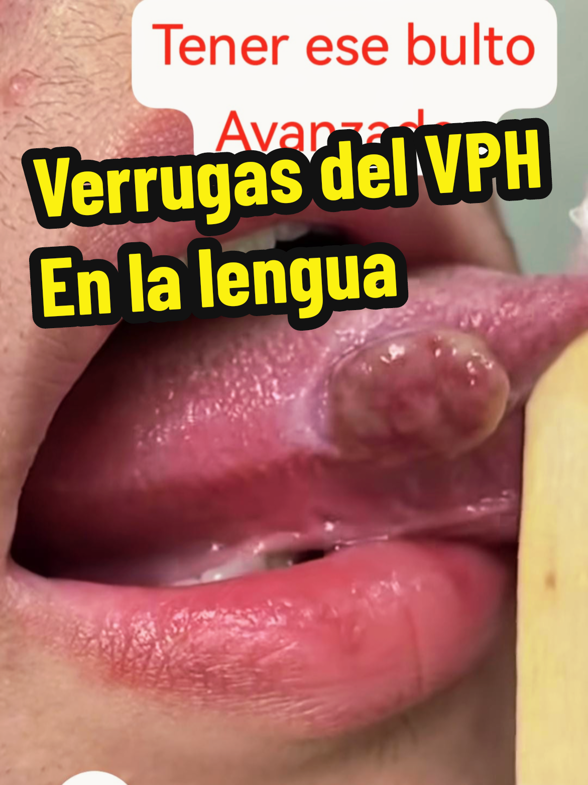 @VPH2025