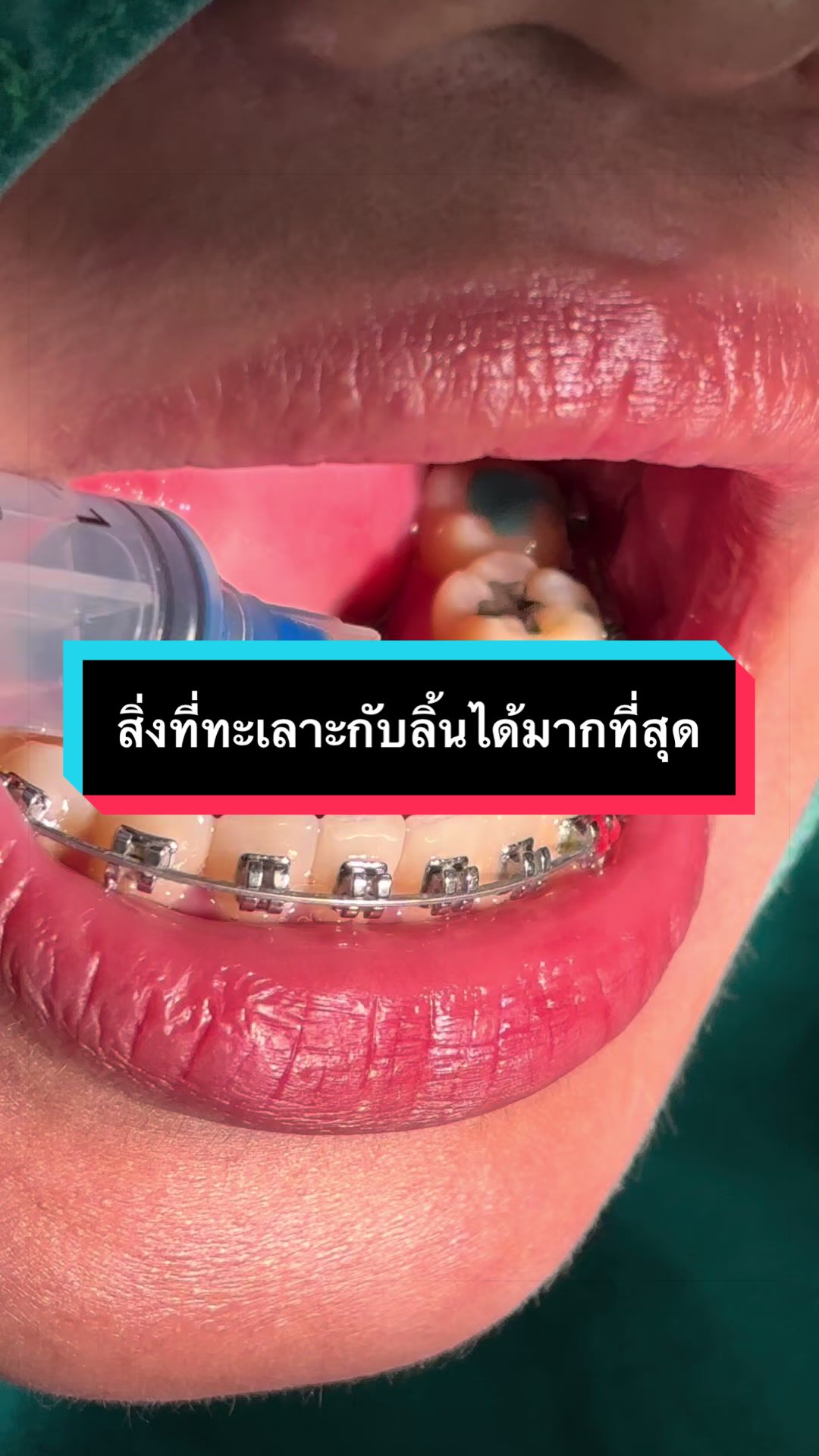 @ซอฟแอนด์สไมล์ลาดกระบัง