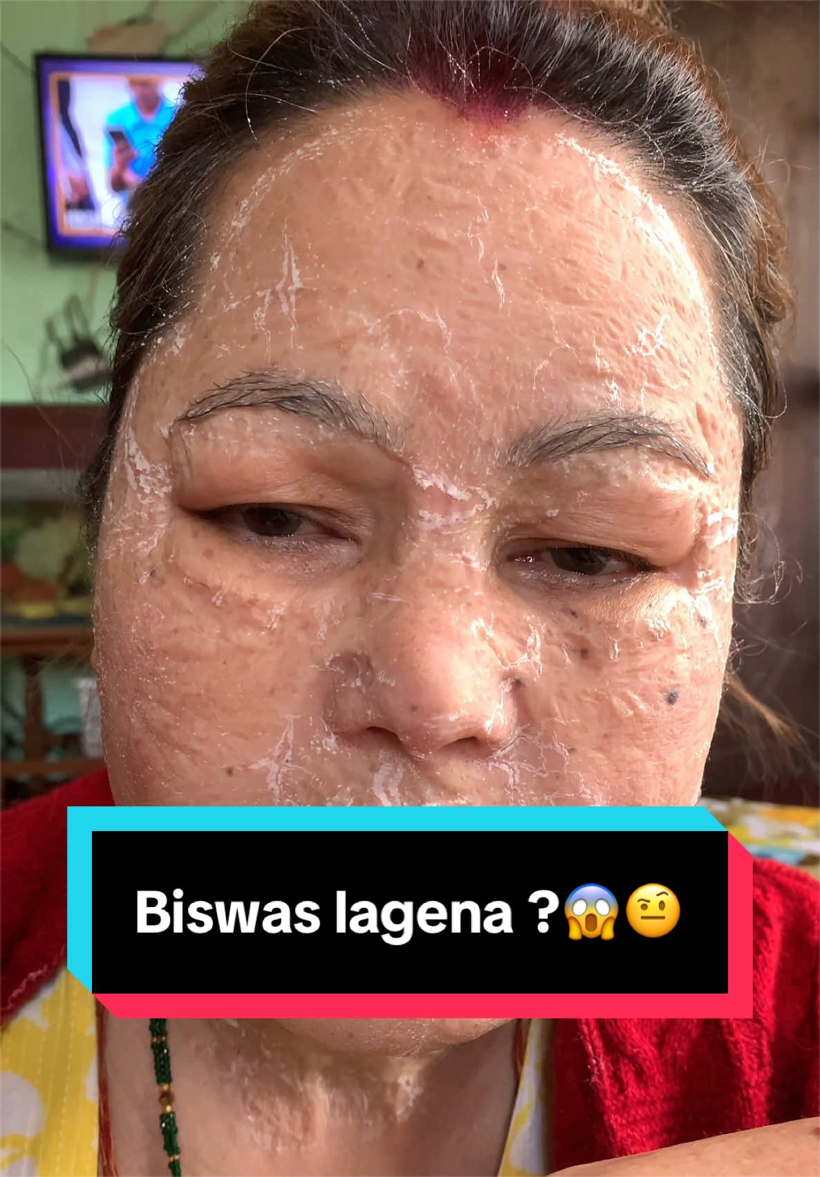 @Minimagic Skincare🇳🇵
