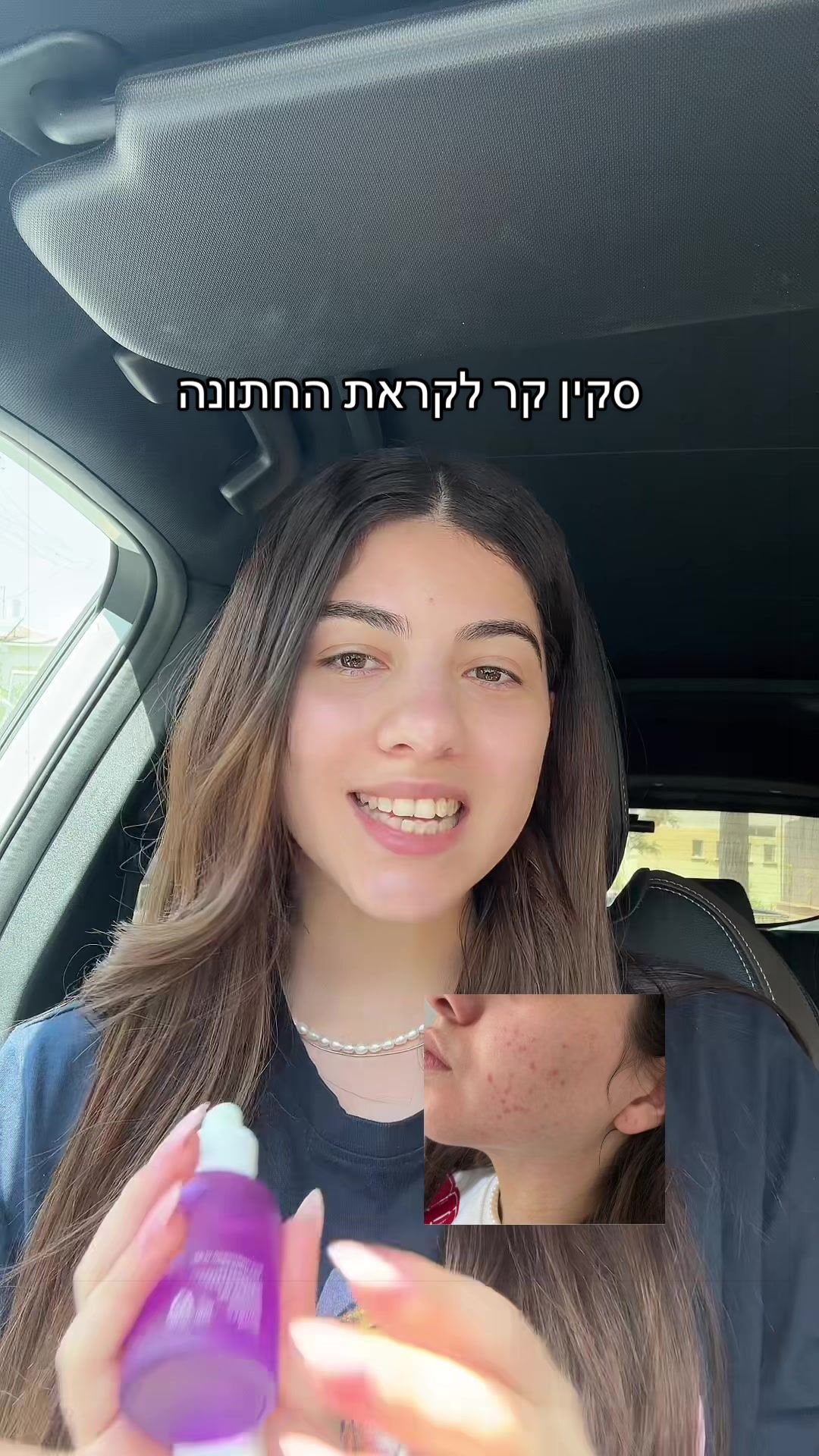 @NofarGG