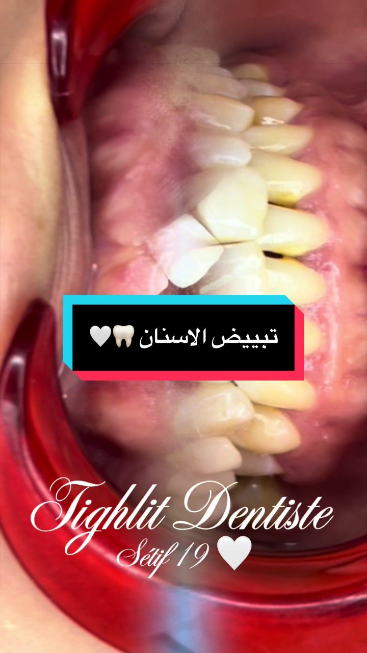 @tighlit_dentiste🦷