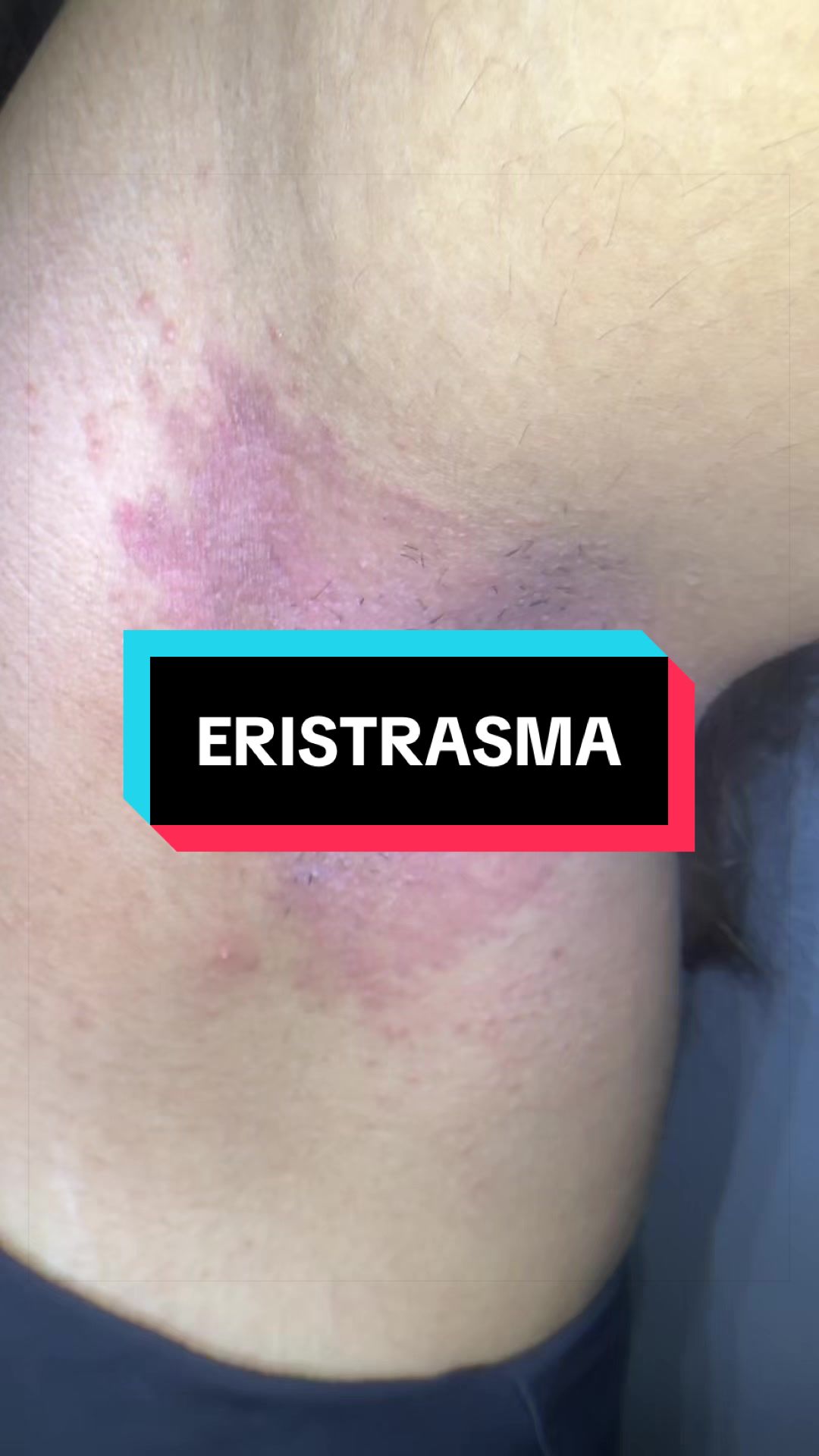 @Dr. Wilfrido Solano Derma