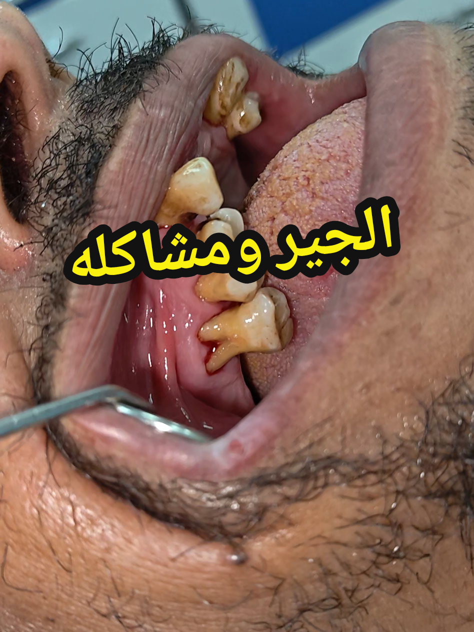 @Ahmed Fattouh | أحمد فتوح