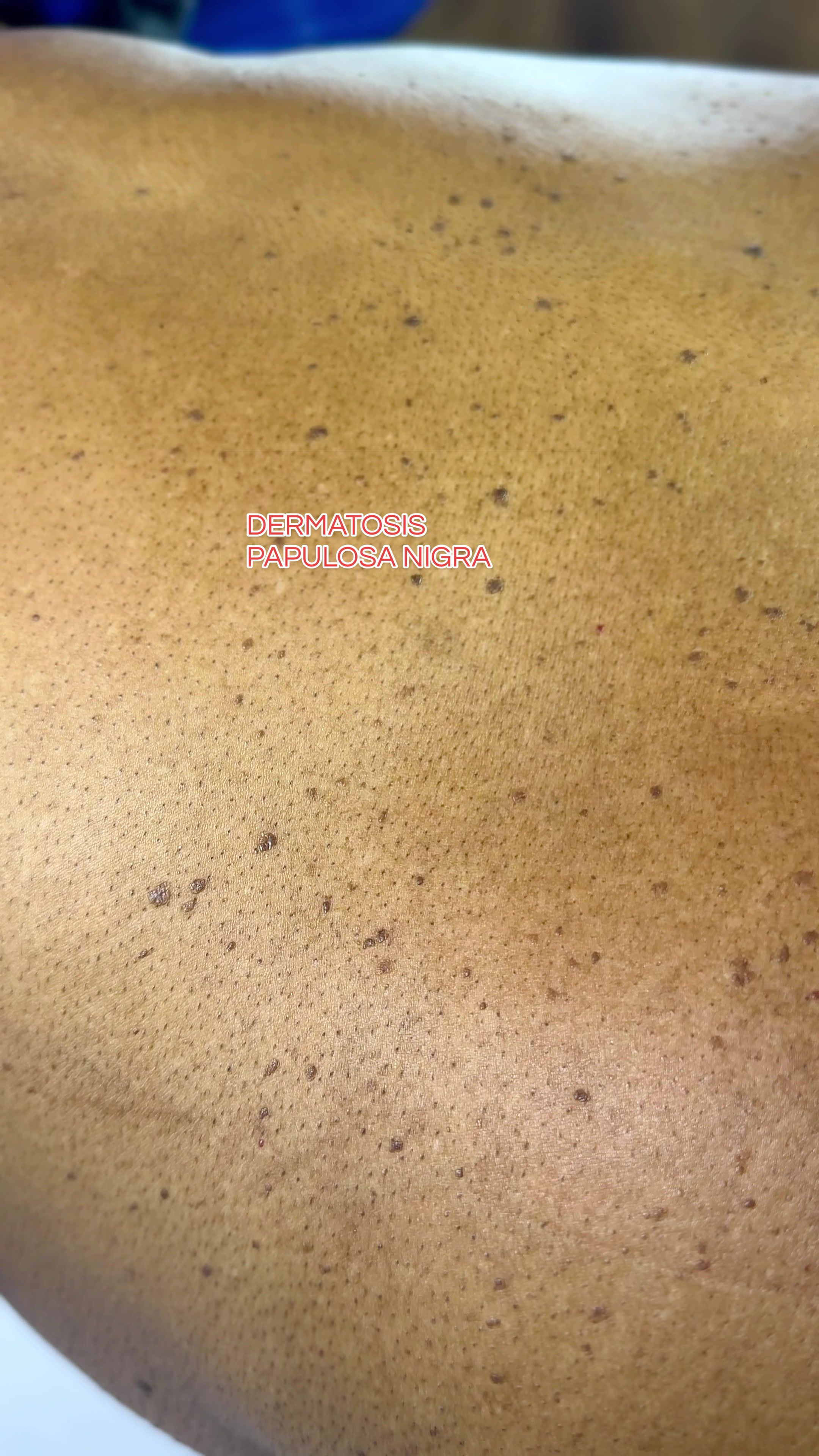@Skin Dictionary