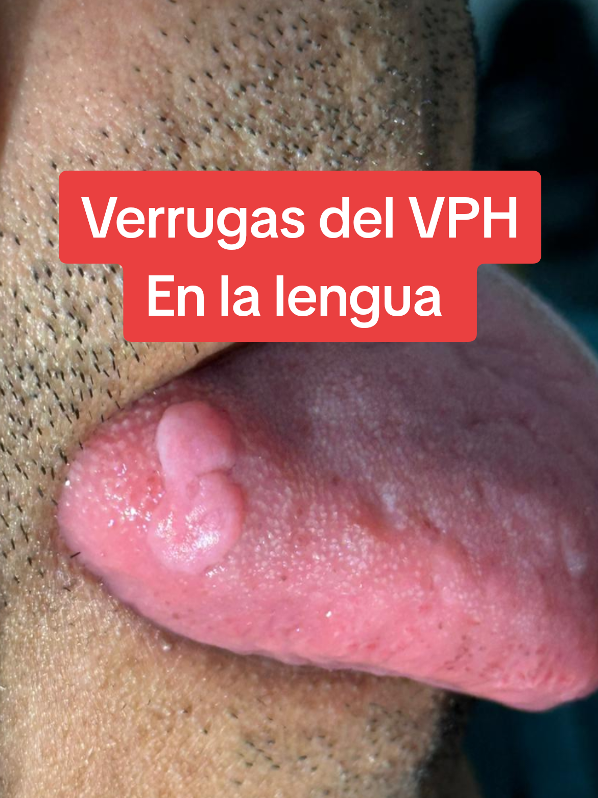 @VPH2025