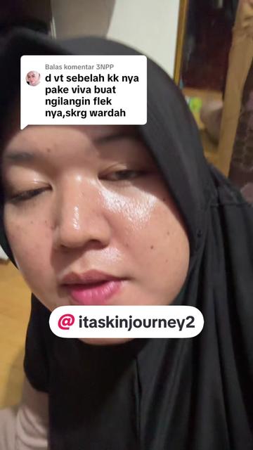 @ita_skinjourney