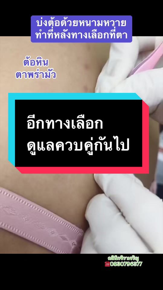 @หมอเชอร์รี่